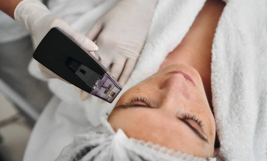 Morpheus8® - Visage et cou ou décolleté (2 zones)